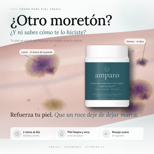 Crema Amparo® | Adiós a los moretones que salen sin saber cómo