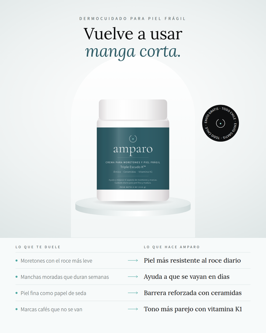 Crema Amparo® | Adiós a los moretones que salen sin saber cómo